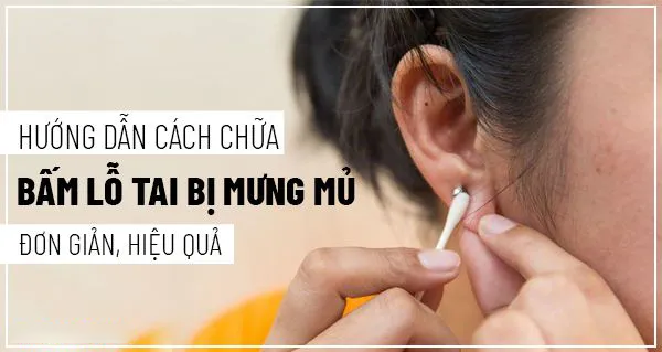 Cách chữa bấm lỗ tai bị mưng mủ tại nhà an toàn nhất